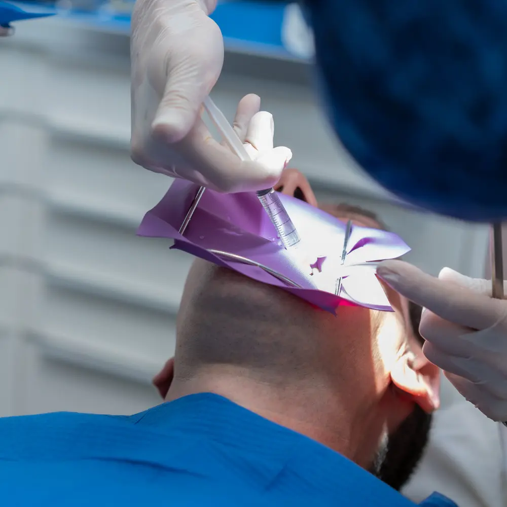 ENDODONCIA - Imagen