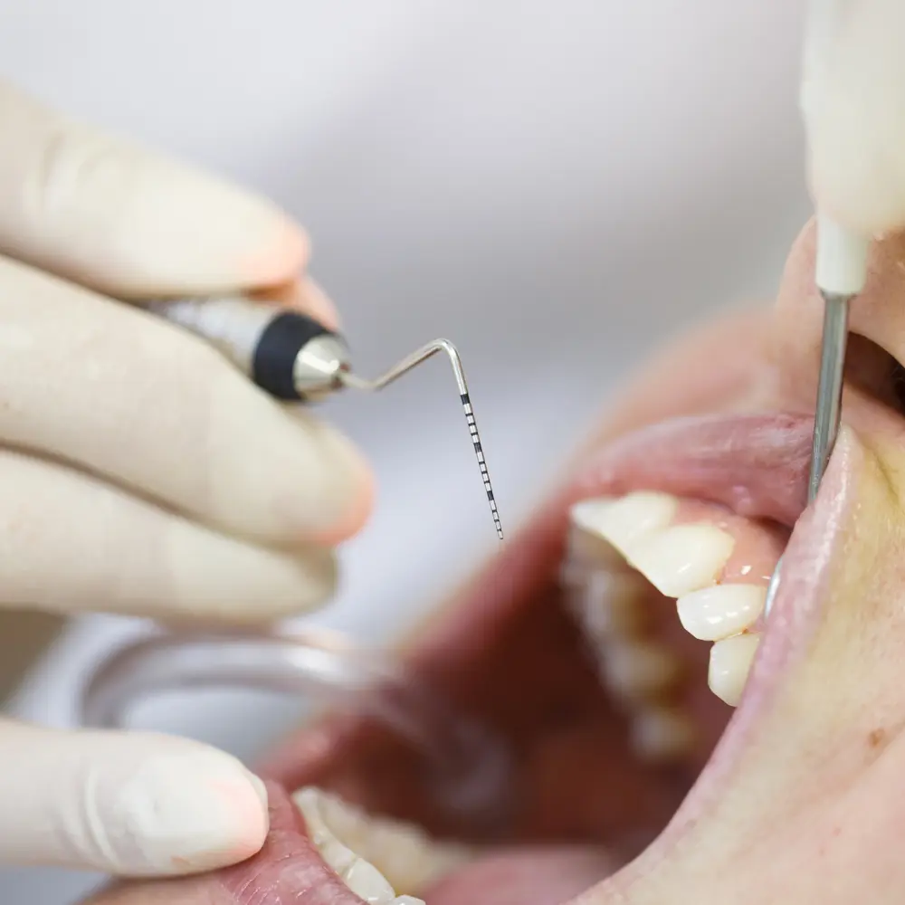 PERIODONCIA - Imagen